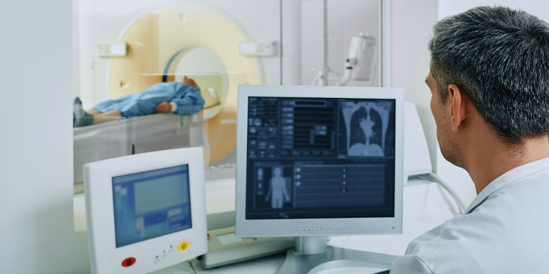 Lung Cancer: Understanding The Role of CT Scans in Early Diagnosis